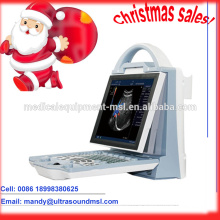 MSLCU23M, ventes de Noël, appareils portables d&#39;ultrasons couleur / machines à ultrasons pour ordinateur portable
